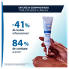 Creme-Facial-Keracnyl-PP--Cuidado-Antiacne-30mL--3282770141320