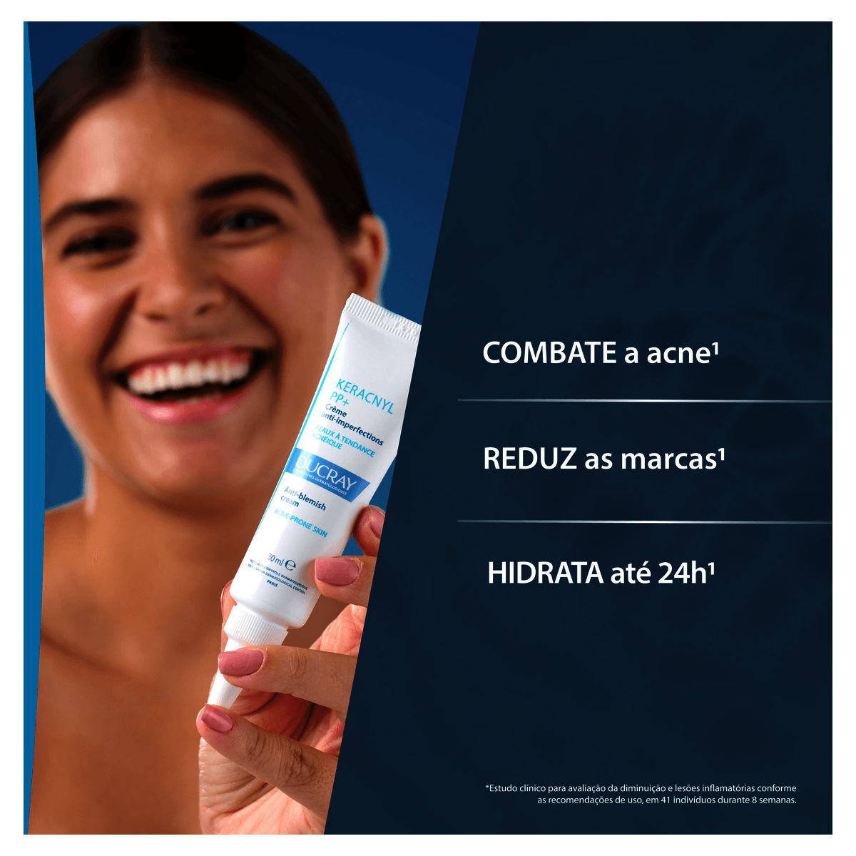 Creme Facial Keracnyl PP+ Cuidado Antiacne 30mL - Imagem 4