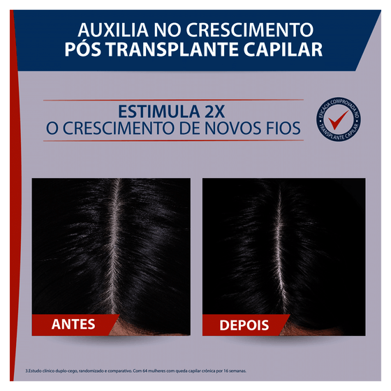 Sérum Antiqueda Ducray Neoptide 50mL - Imagem 6