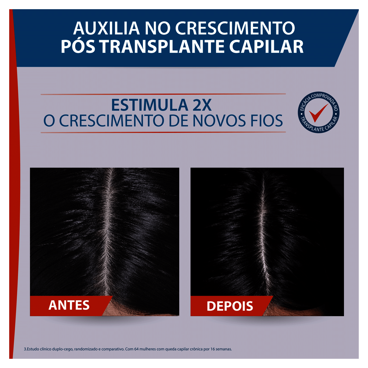 Sérum Antiqueda Ducray Neoptide 50mL - Preview 6